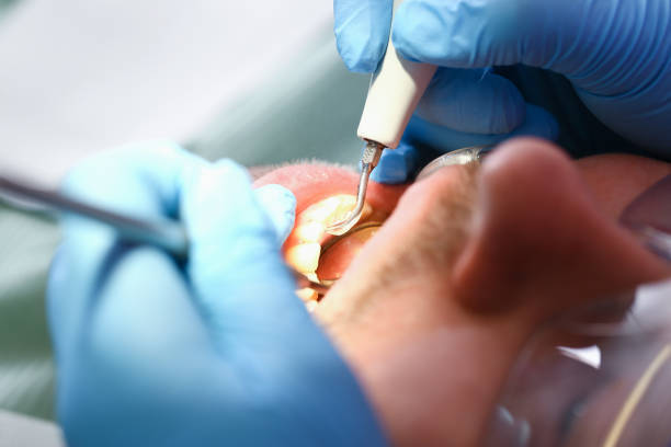 Best Emergency Care for Gum Disease in Oskaloosa, KS