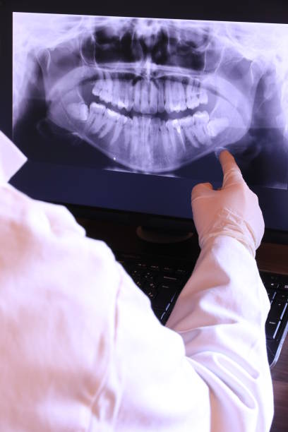 Best Broken or Chipped Tooth Repair in Oskaloosa, KS